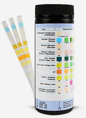 urinalysis-test-strips-urine-dipstick-test_1.jpg