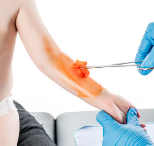 Vesismin_Aquaseptic_Orange_1