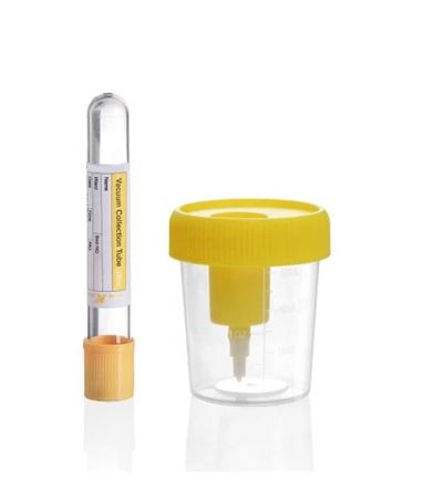 conjunto orina 60 ml vacio