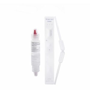 Tuberculosis IgG/IgM test cassette